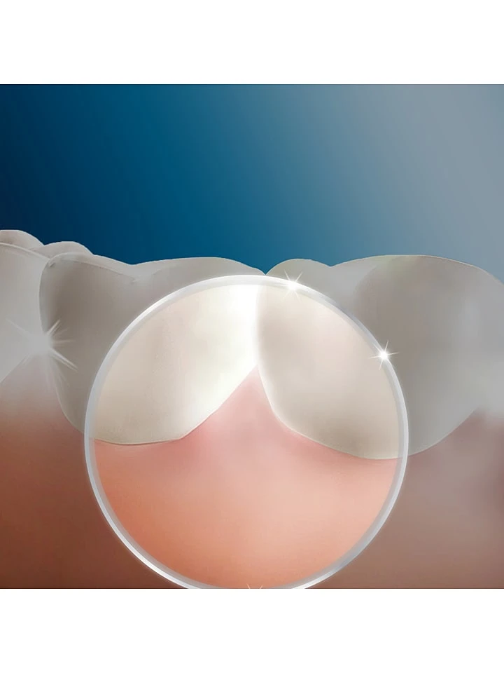 Oral B 5tlg. Mundduschen-Set "Oral-B OxyJet" In Weiß/ Blau 3 Oral B 5tlg. Mundduschen-Set "Oral-B OxyJet" In Weiß/ Blau – Bild 3